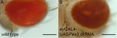 Rosy Beginnings: Studying Peroxisomes in Drosophila